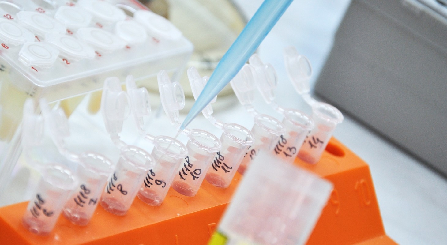 closeup of orange test tube tray with blue pipette