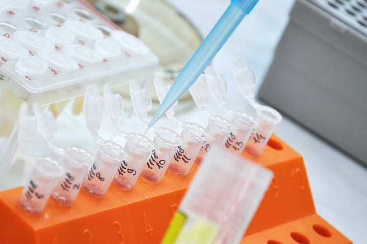 closeup of orange test tube tray with blue pipette